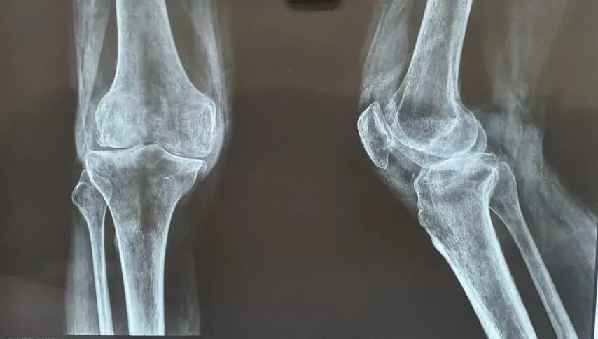 Digital X-ray machine at the clinic