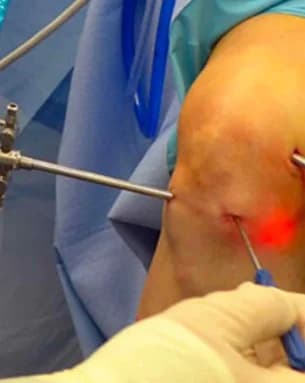 Arthroscopy instruments and knee model